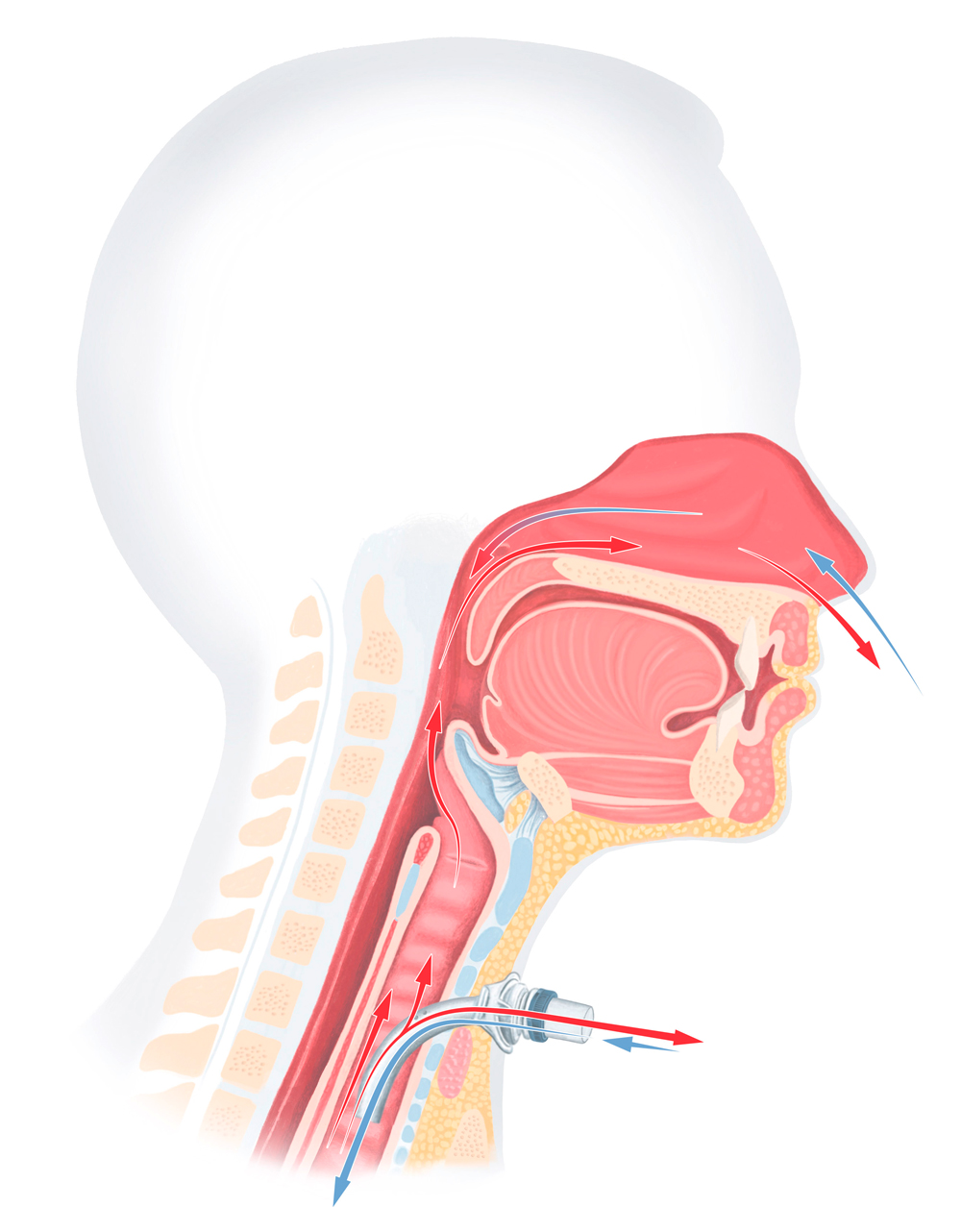 Anatomische Illustration eines Menschen mit Luftzirkulation nach der Tracheotomie